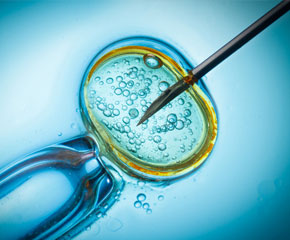 IVF